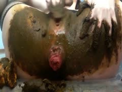 Scat Lina Prolapse